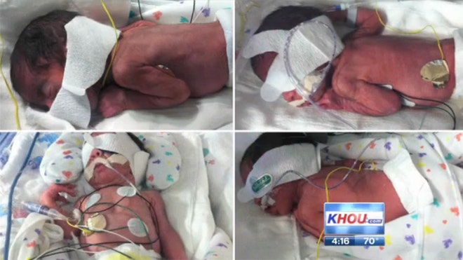 Two Sets of Twins_KHOU in Houston.jpg